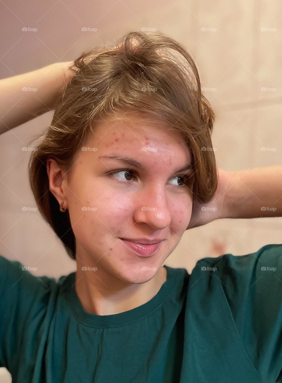 A teenage girl with non-perfect skin.