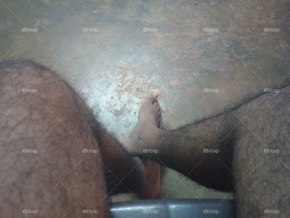 hairy legs