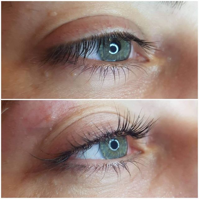 Eyes closeup