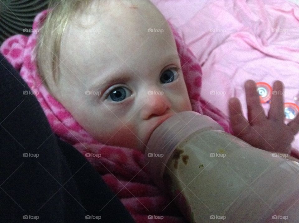 Baby with Down syndrome drinking from bottle