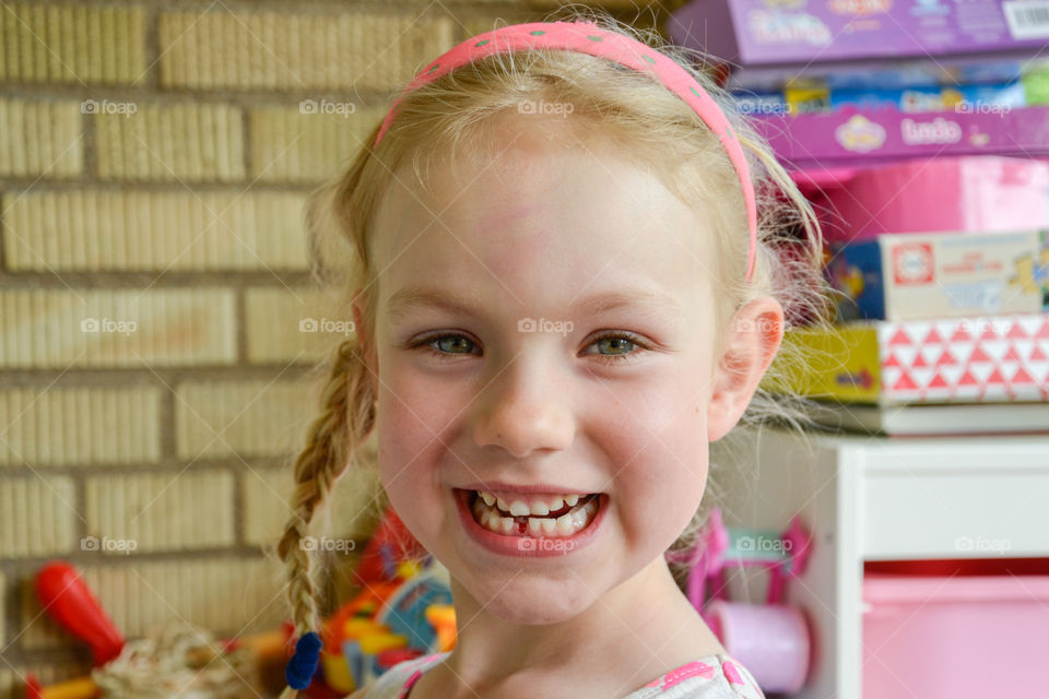 Three year old girl has lost her first tooth.