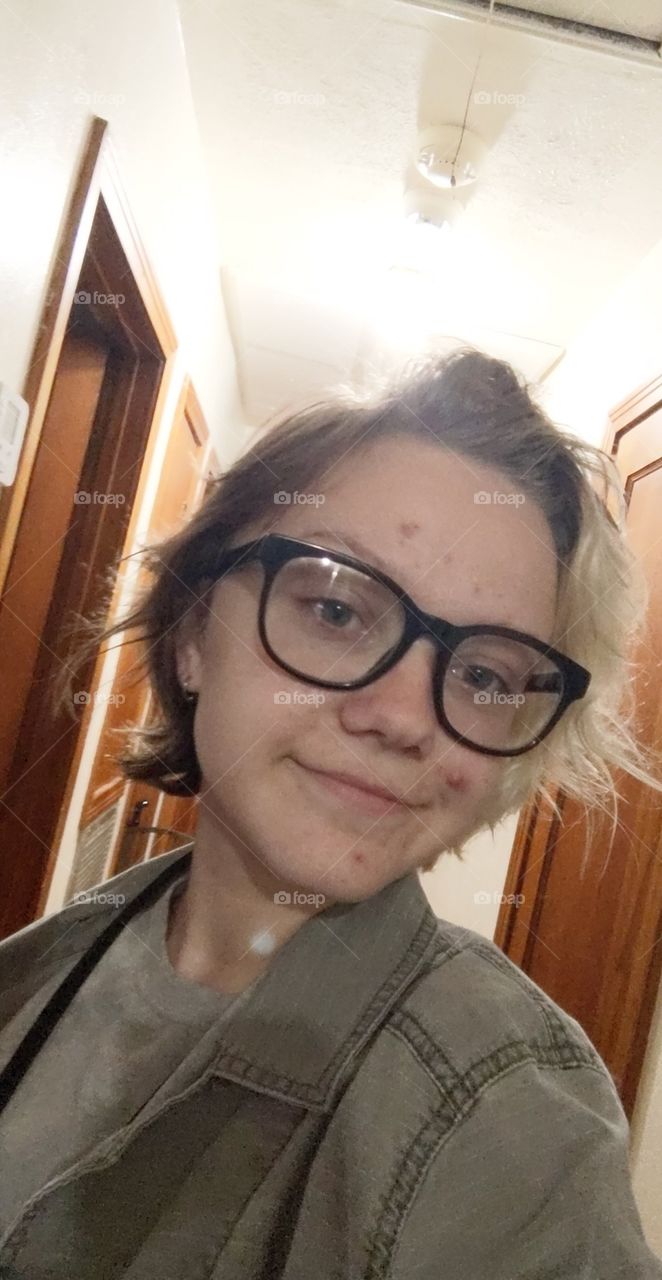 beautiful even with acne