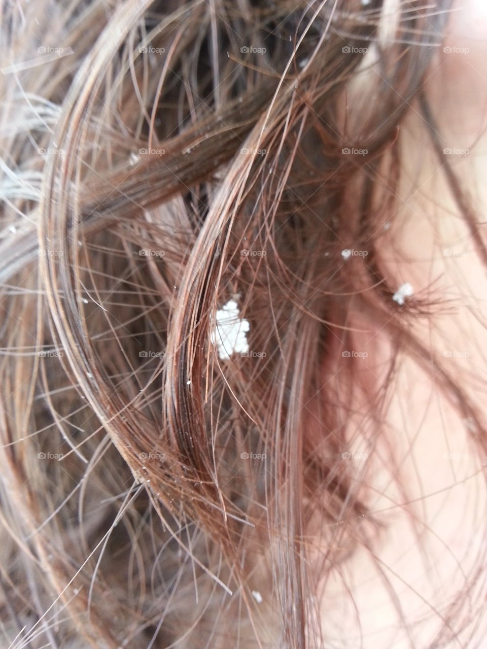 Snowflake in her hair