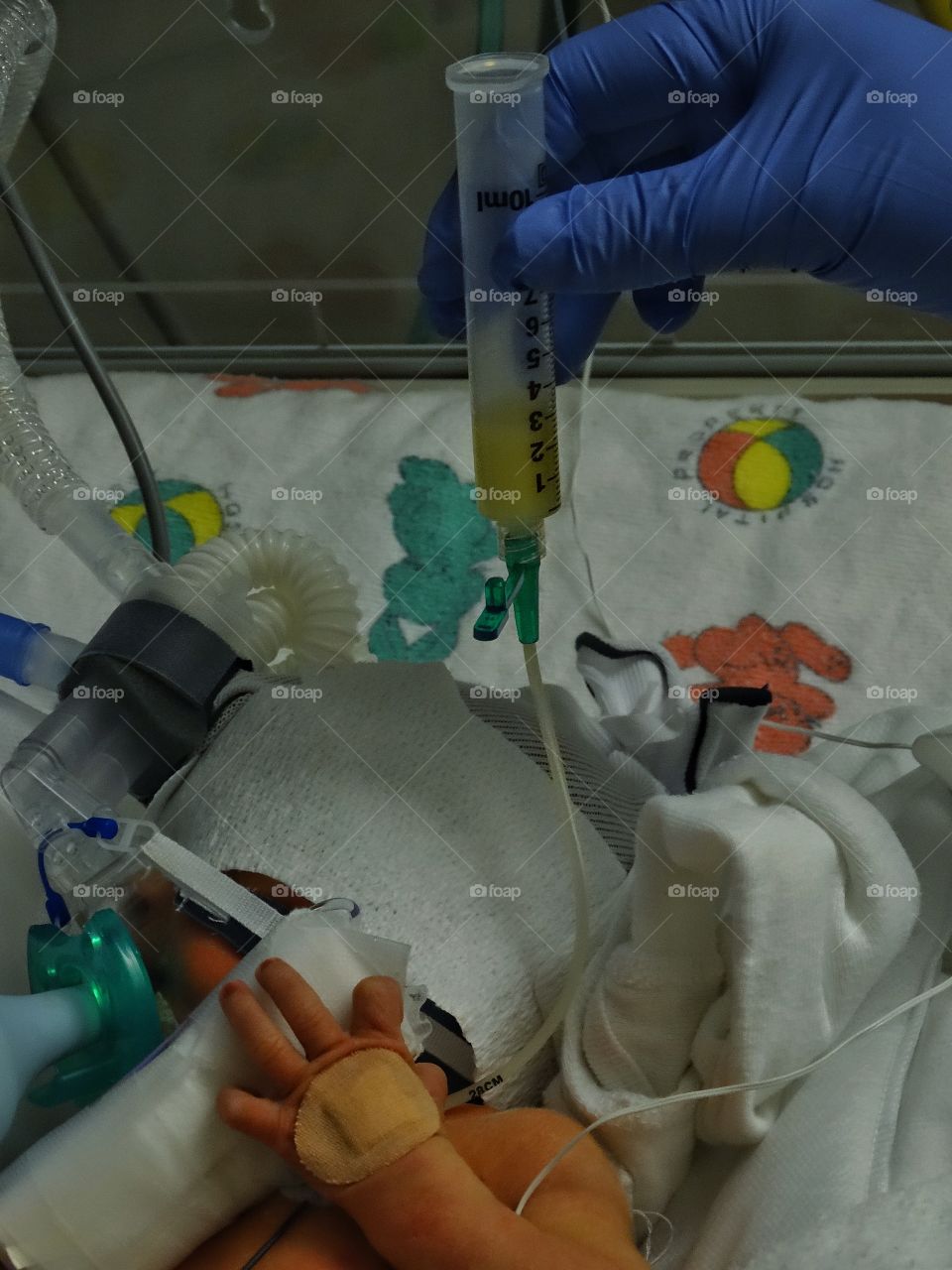 Premature Newborn Receiving Intensive Care