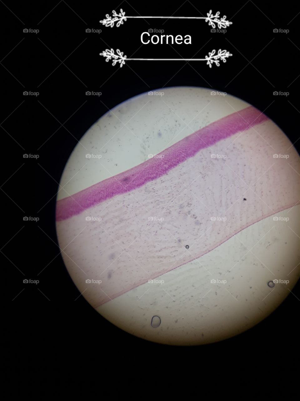 cornea picture under microscope