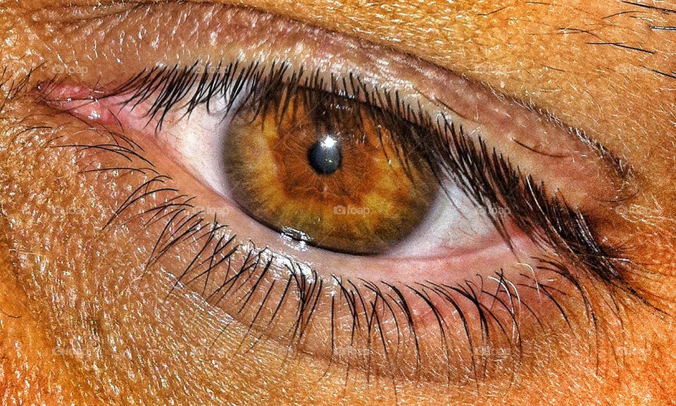 My eye