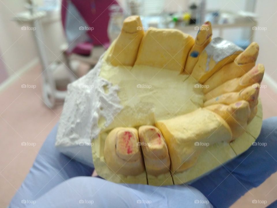 Dental model
