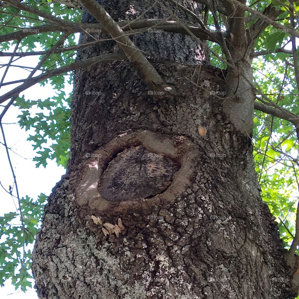 Trees Can Heal Their Own Wounds! 🌲🌳
Ring of Healing Around Lost Limb!