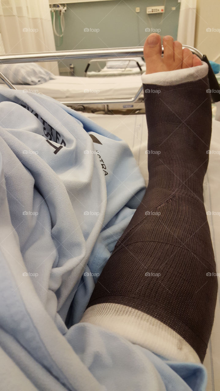 Short leg cast foot surgery  - gips fotoperation sjukhussäng