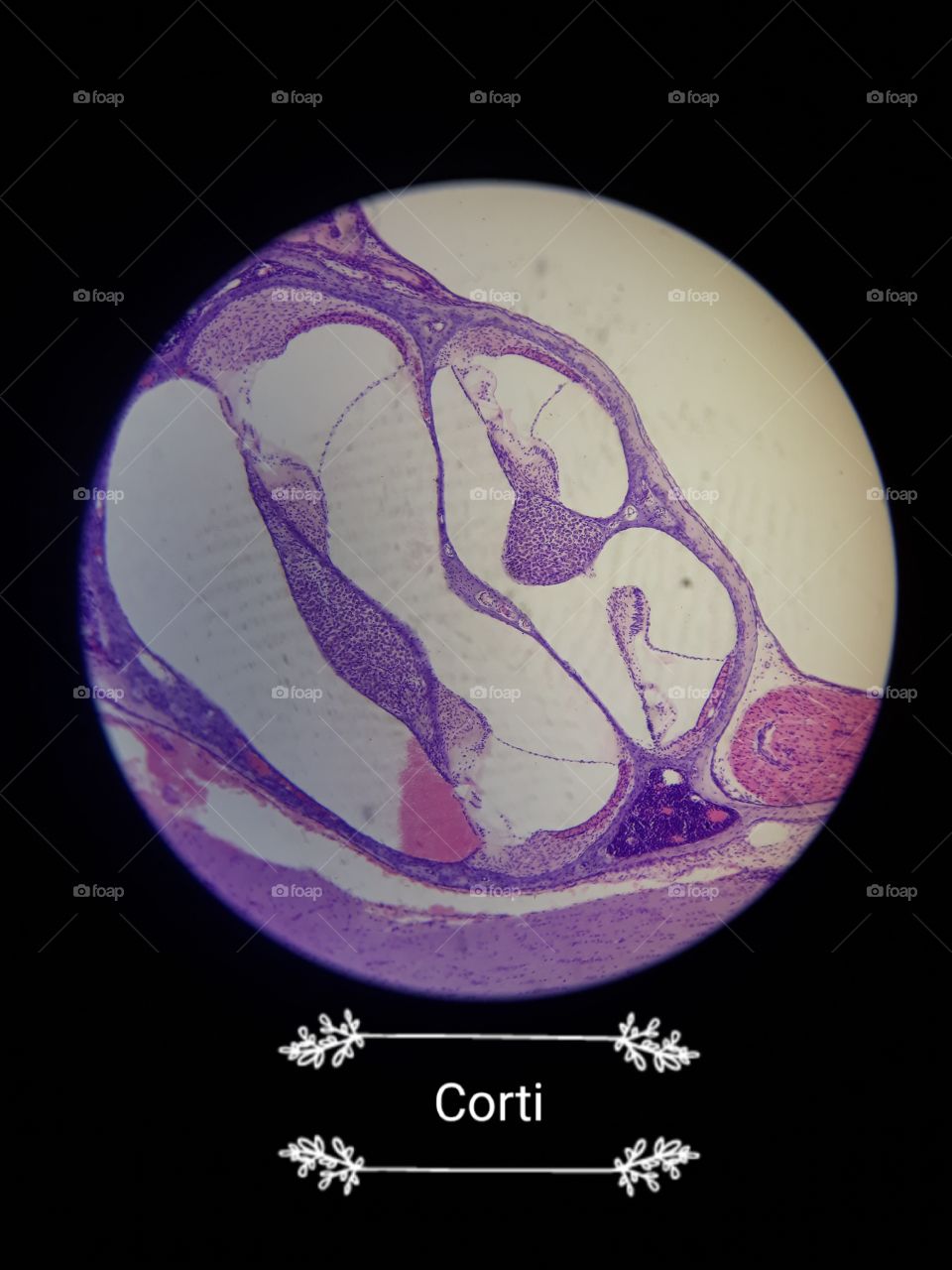 corti picture under microscope