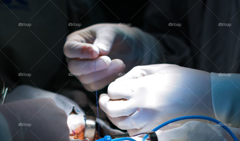 Surgeon using surgical glove holding thread