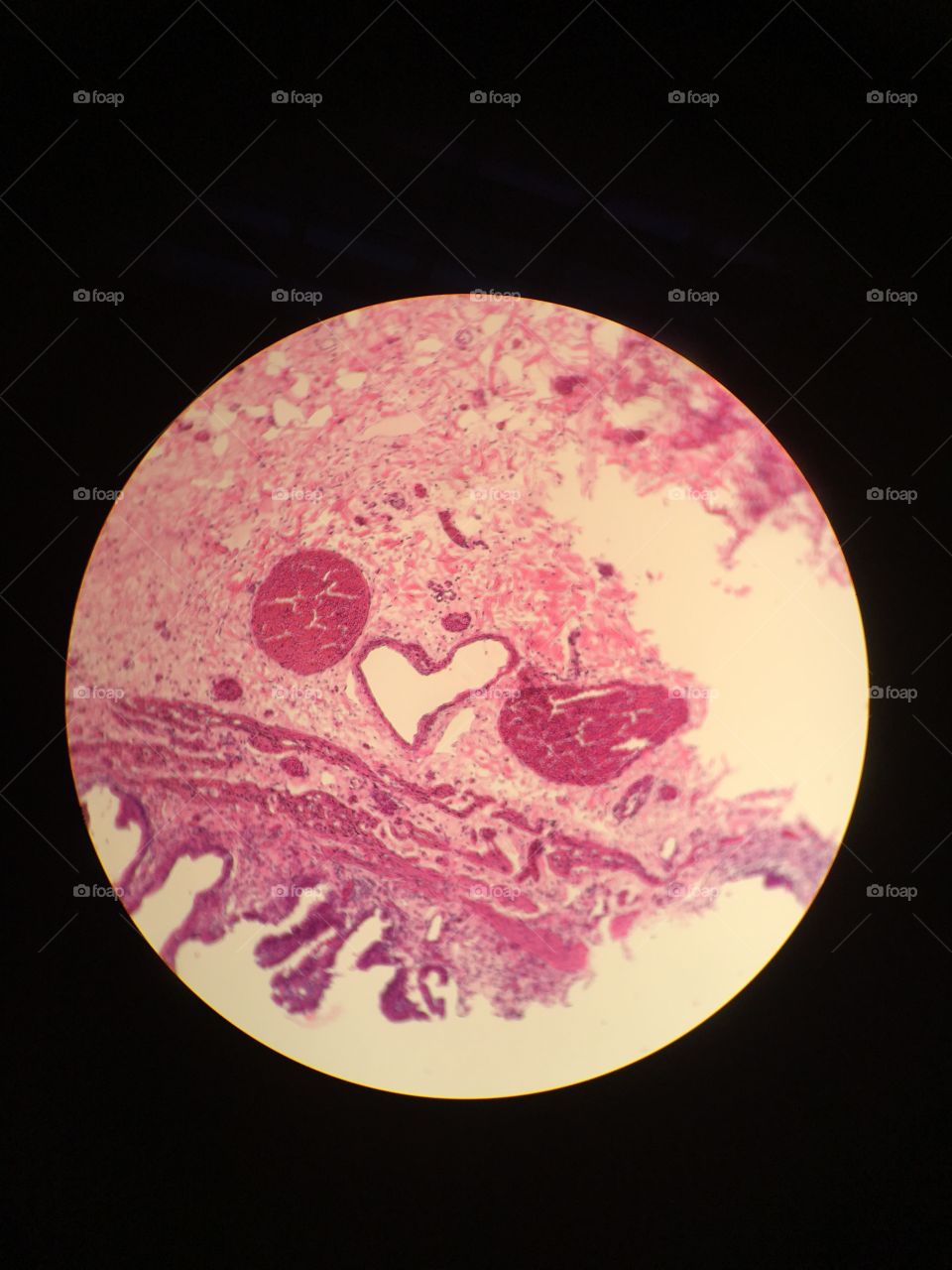 Love heart tissue slide microscope histology 