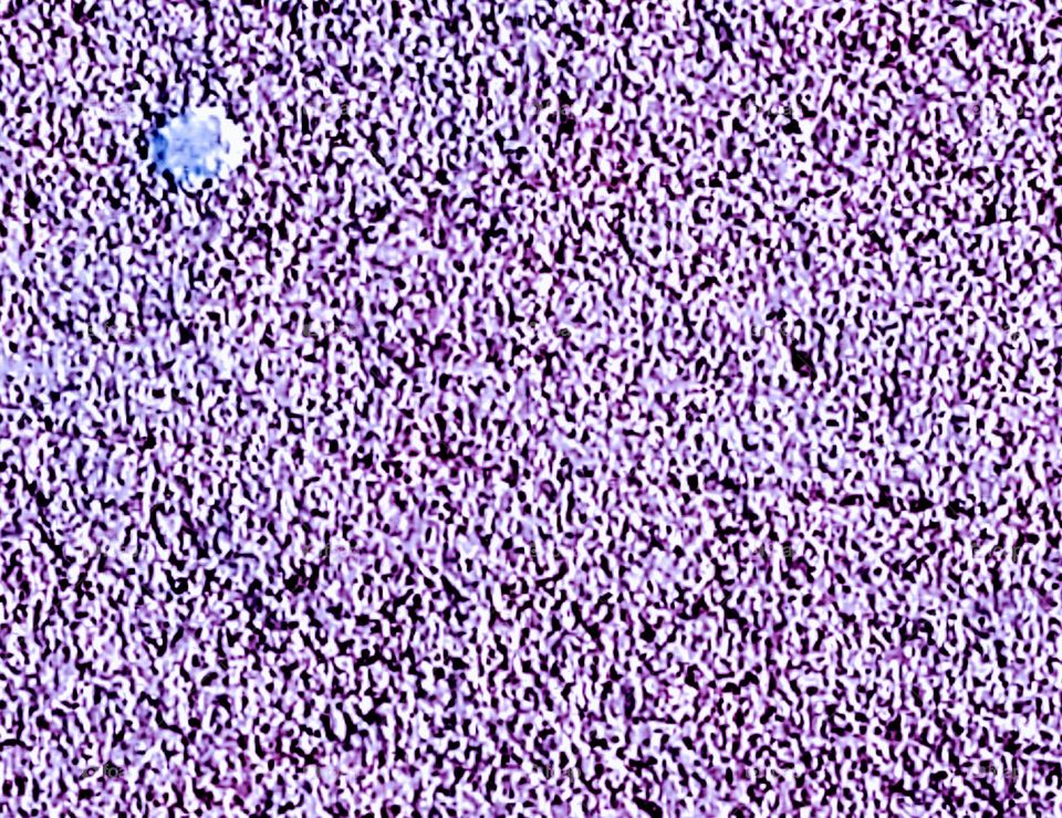purple/white dot