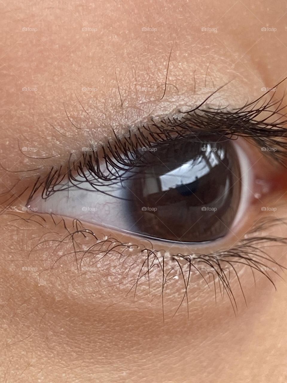 Eye