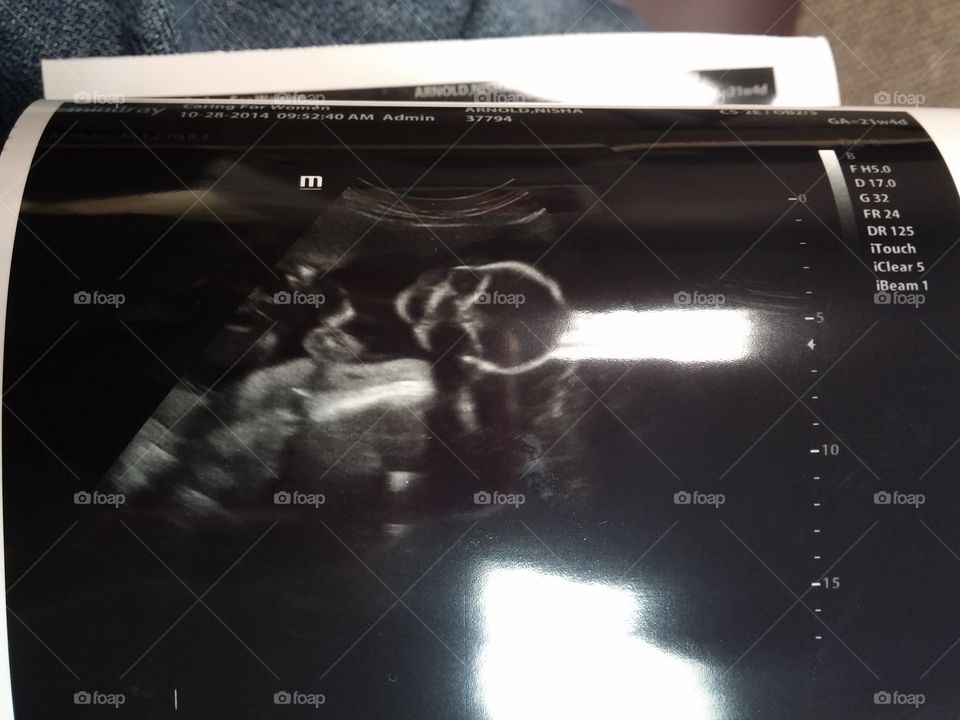 scary ultrasound. Halloween baby