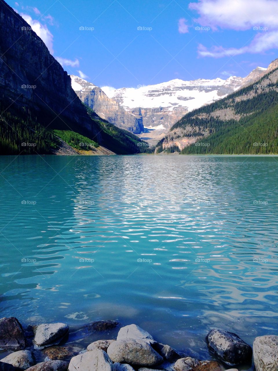 My first time visiting Lake Louise