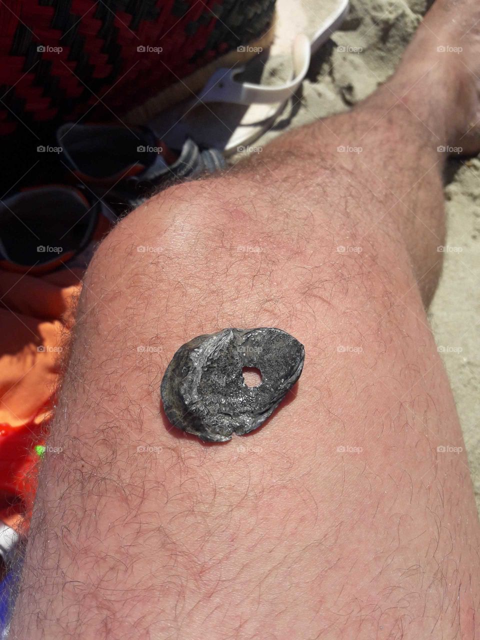 the shell on the leg