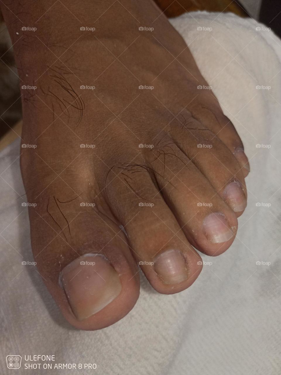 Pie sucio 🤤😋🦶