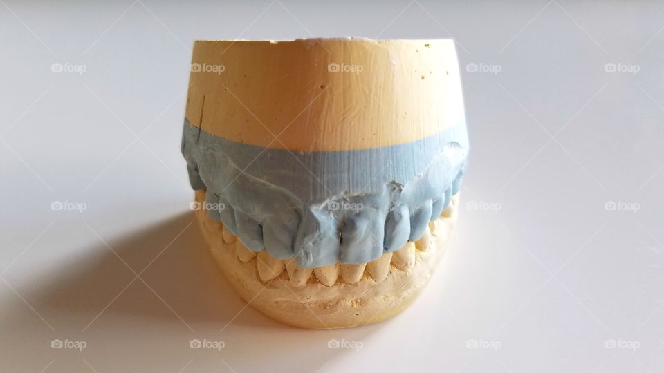 Teeth impressions
