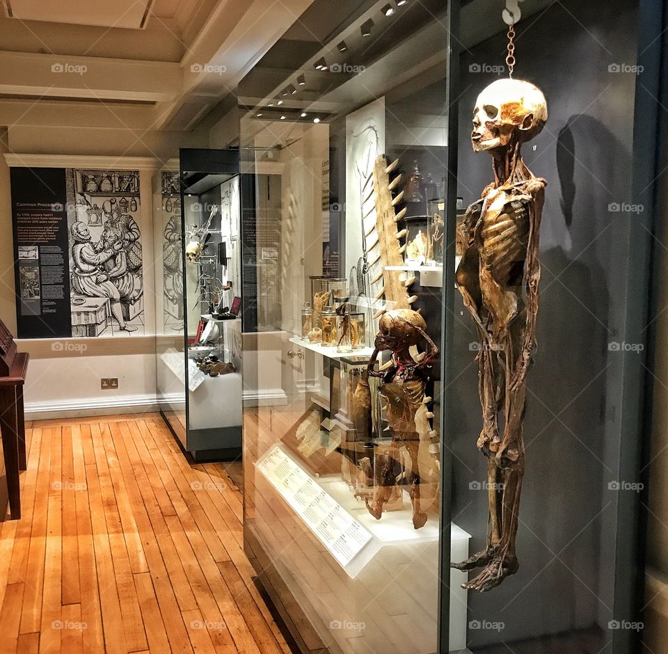 Anatomical specimens are shown in a gallery at a Surgeons Museum