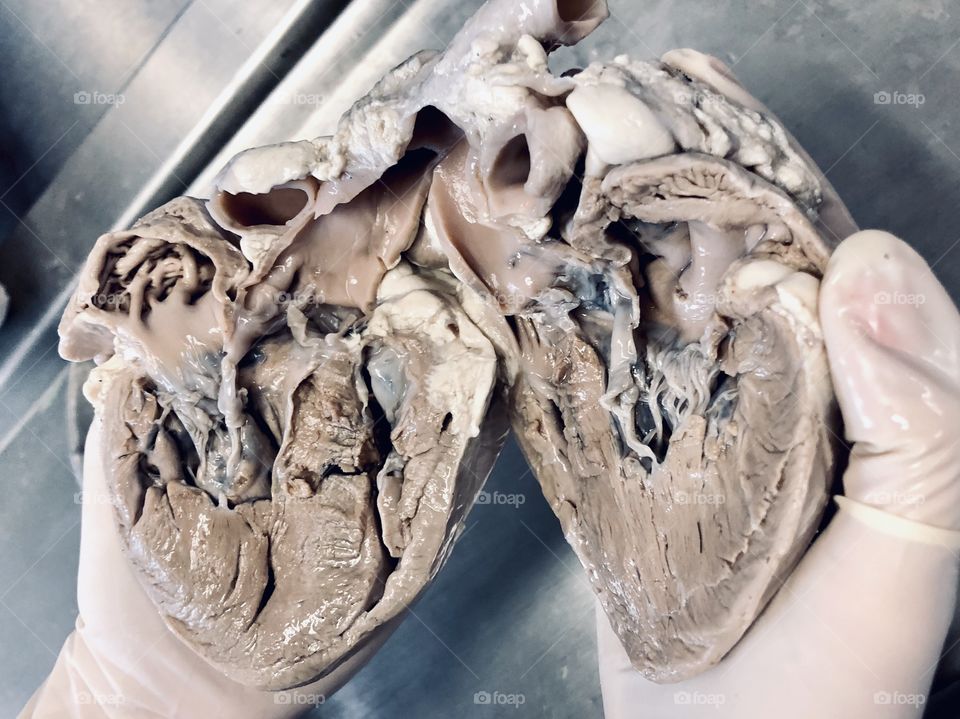 Dead Feelings. This is a picture of heart’s anatomy