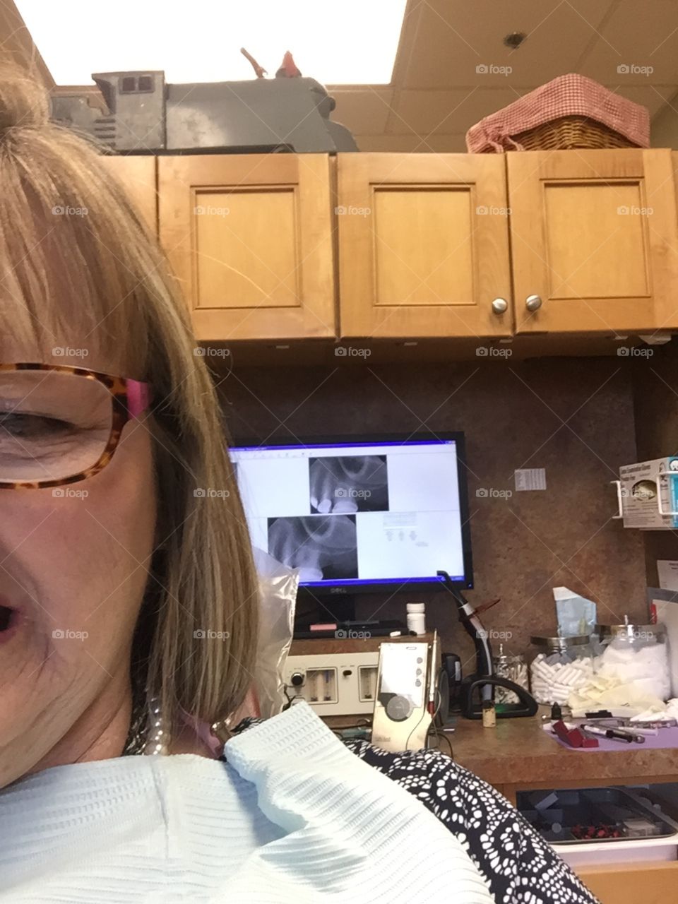 Lady in dental chair