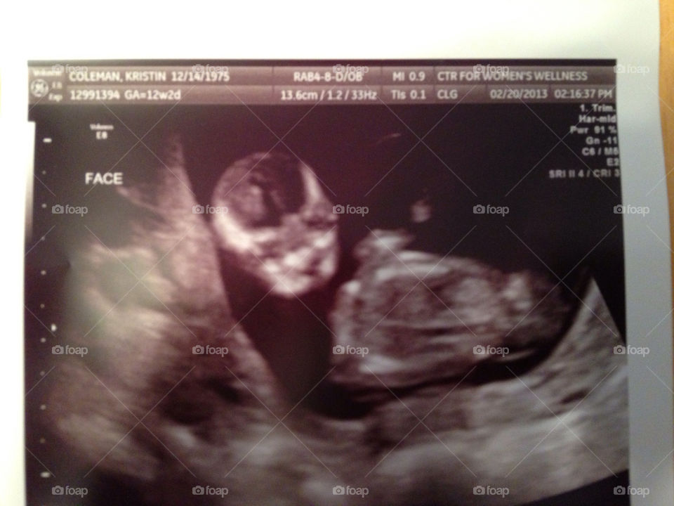 Fetus, Ultrasound, People, Maternity, Scanning