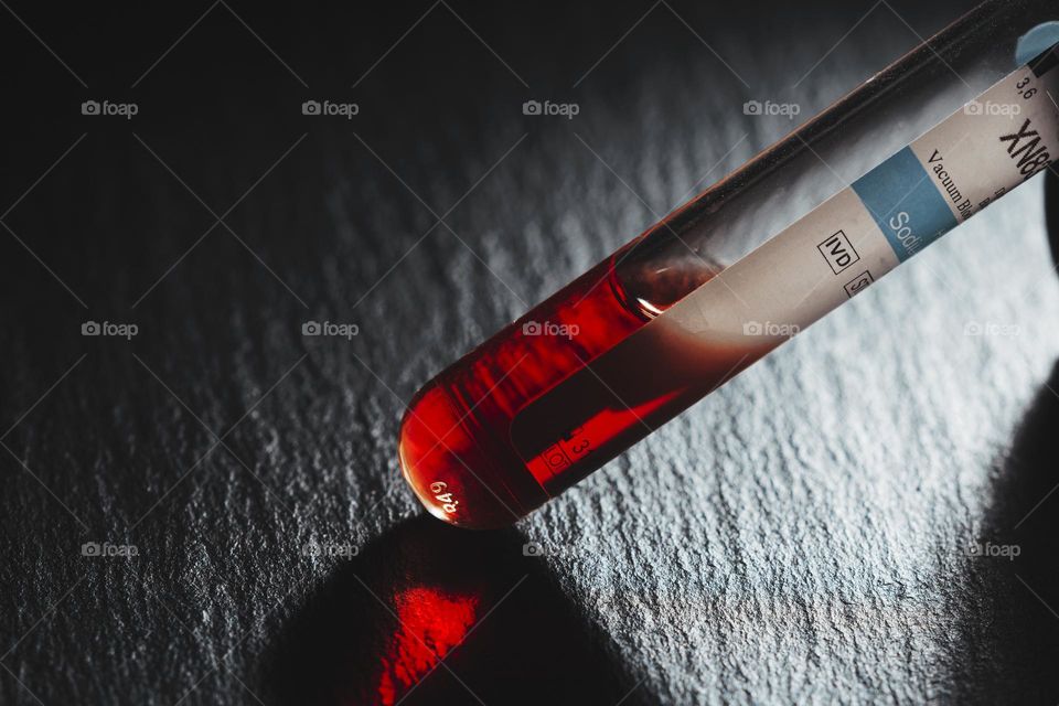 medical analysis, research concept .  laboratory test tube, biochemistry blood test close up.